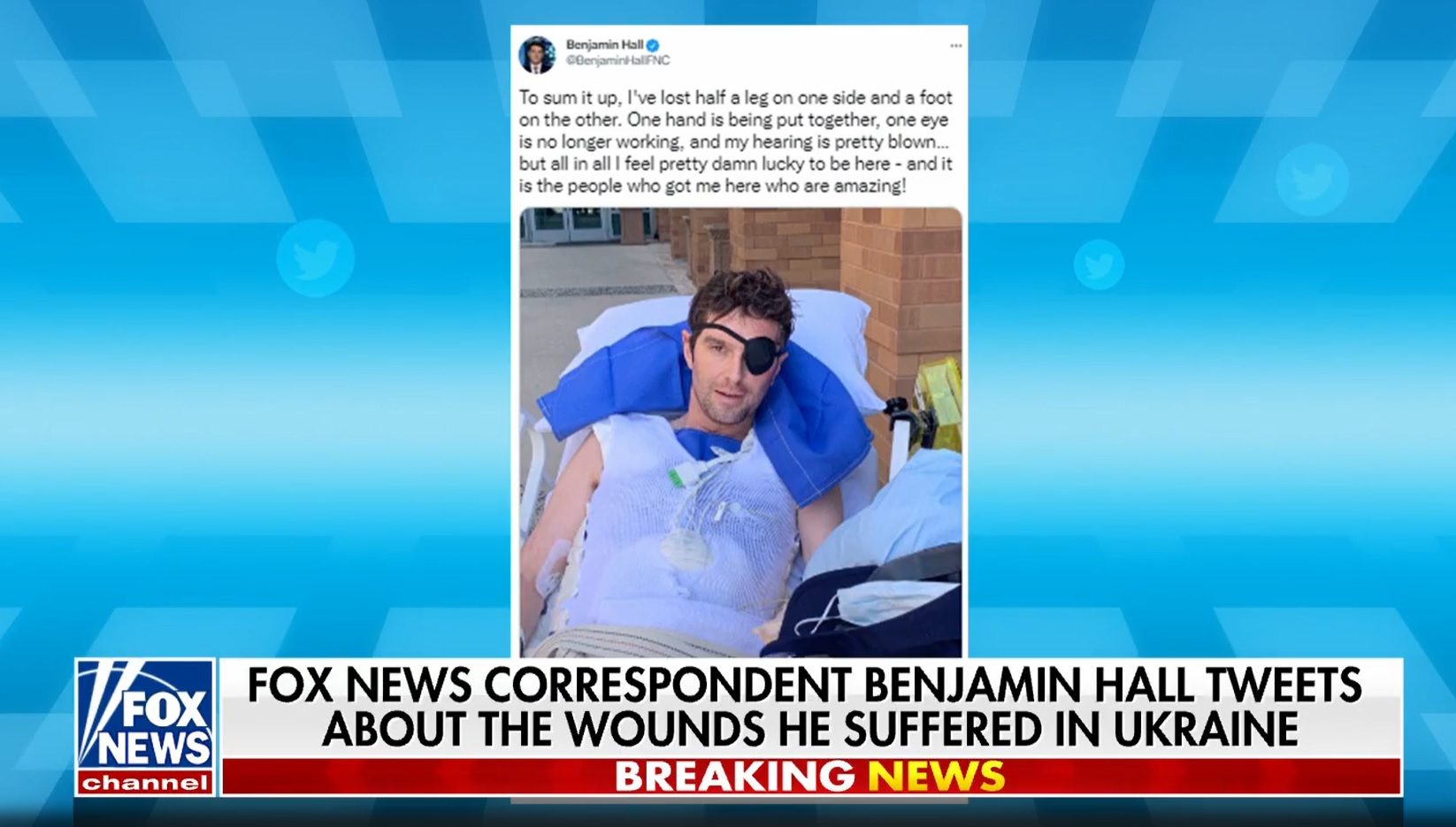 A Fox News operatőre meghalt, tudósítója elvesztette a lábát Kijevben