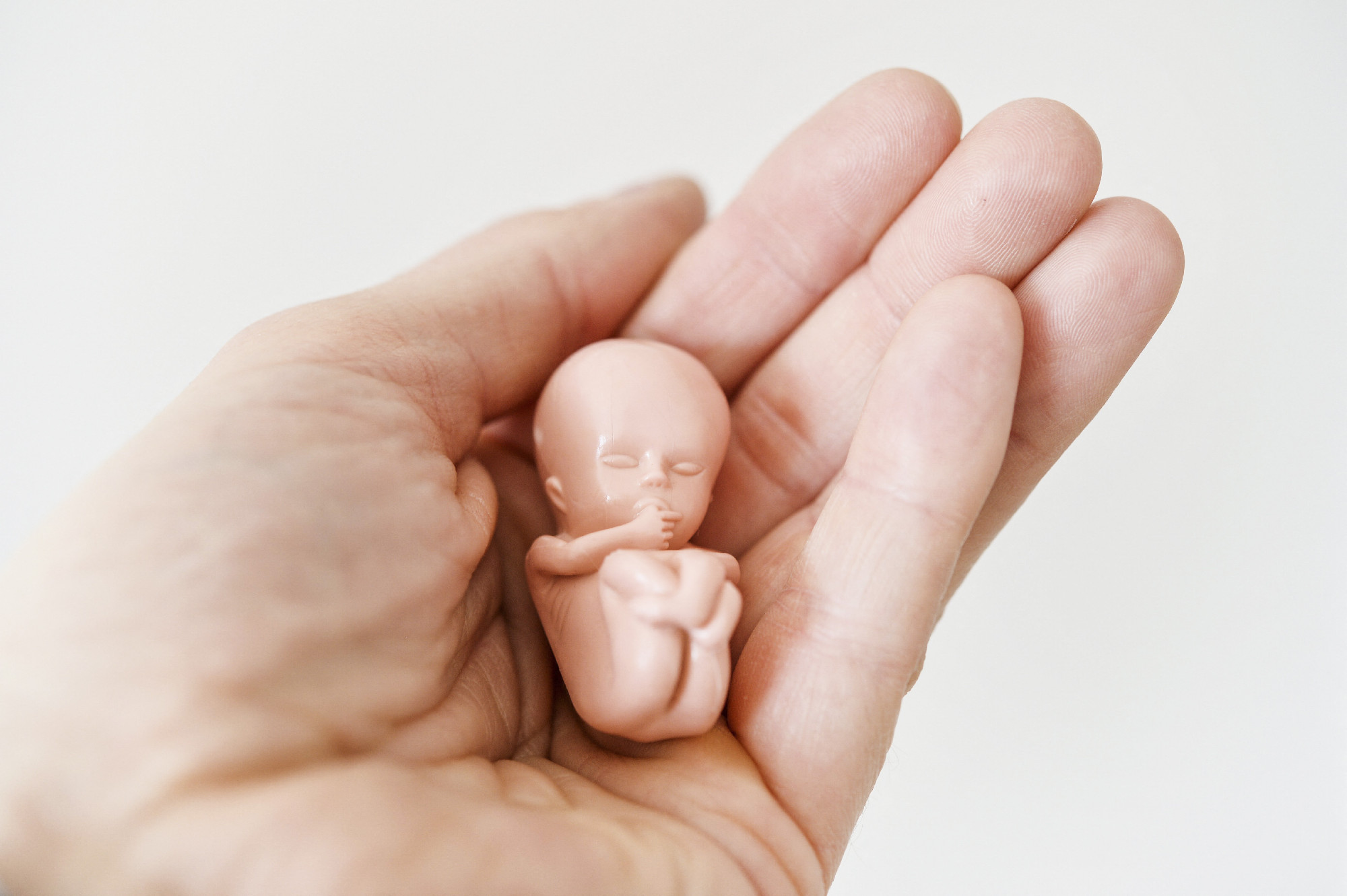 A MOK támogatja Pintér abortuszt érintő rendeletét