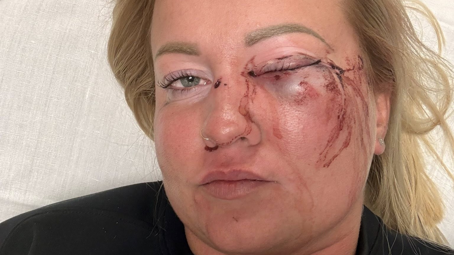 Szentmártonkáta polgármestere a megvert asszonyról: Eléggé teltkarcsú, nem hinném, hogy ajánlatot tettek neki