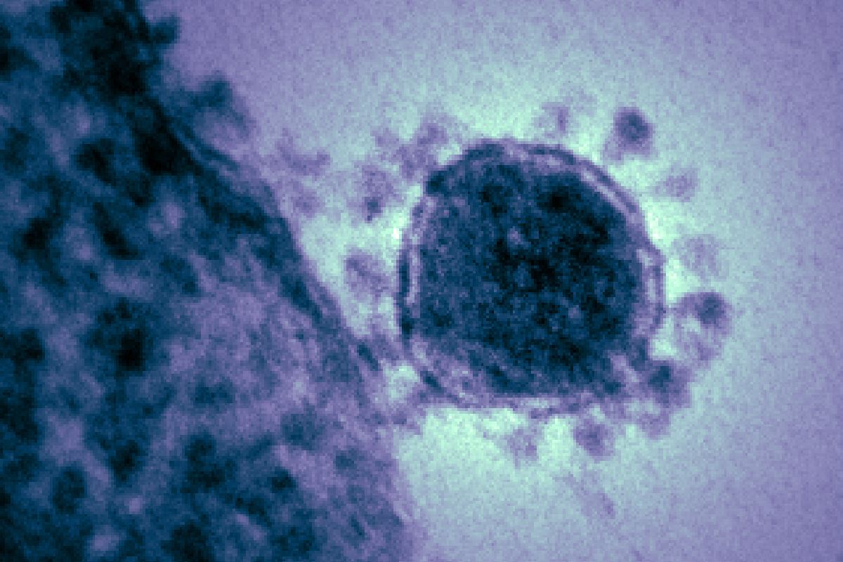 Megnő a vérrögképződés kockázata a koronavírus-fertőzés utáni hat hónapban