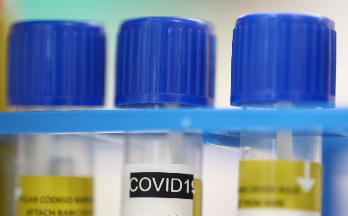 Aggasztó hírek Dél-Koreából: gyógyultak szervezetében jelent meg újra a koronavírus