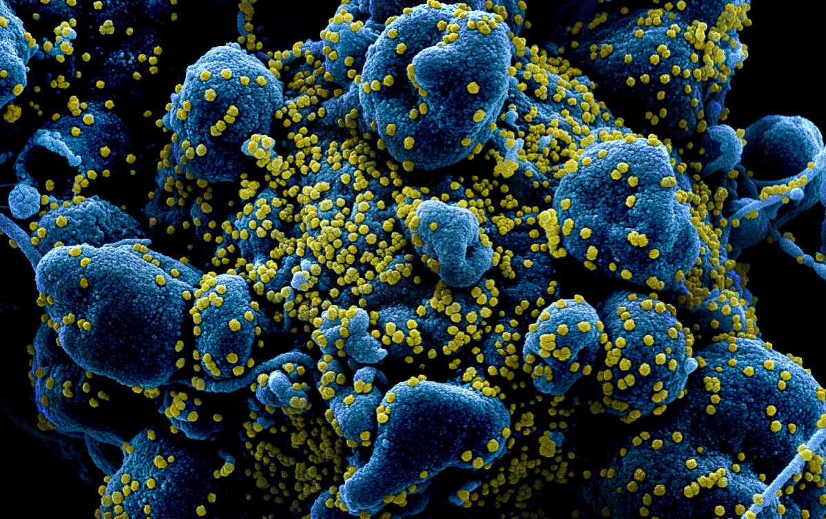 Világszerte több mint 12 ezer koronavírus-fertőzött hunyt el az utóbbi 24 órában