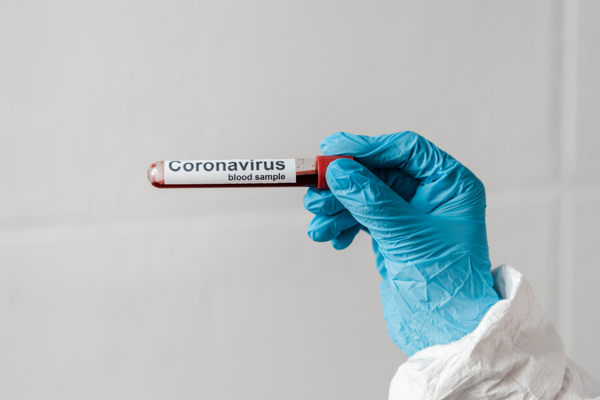 Négy magyar koronavírusos beteg kap vérplazmakezelést