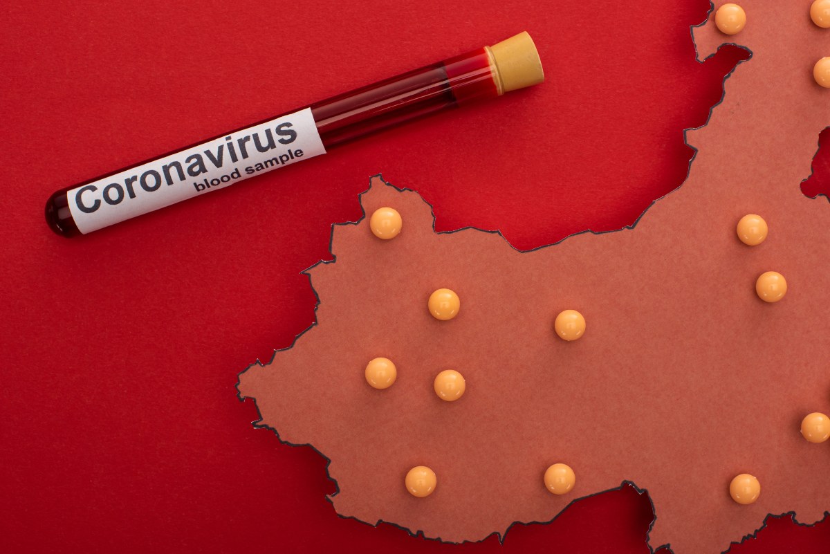 Szlovákia saját koronavírus-tesztet fejlesztett, 100 ezret fel is használnak a következő hetekben